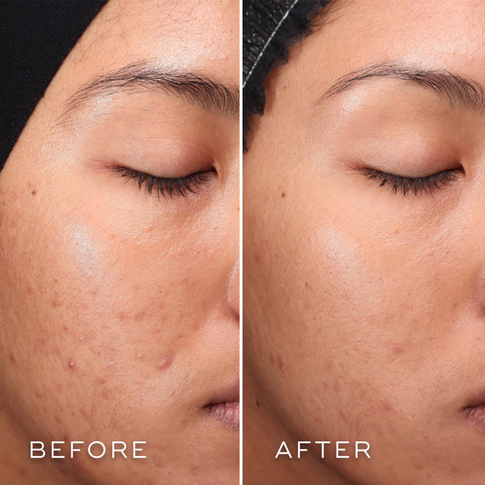 Medik8 Press & Clear Refill - 150ml